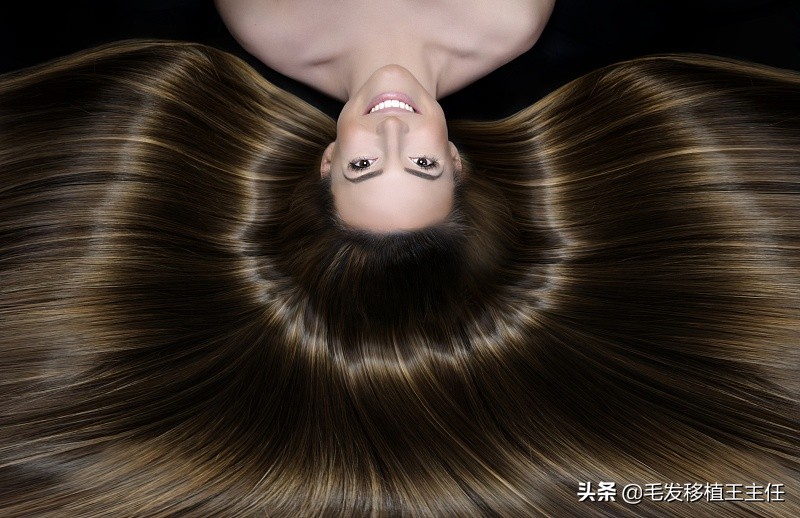 头痒出油头屑多怎么办,头皮特别痒头屑多出油快还爱长痘