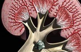 人肾结石疼怎么办,肾结石碎完石后总觉得累