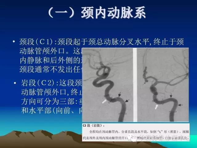 小脑血管解剖分段,脑血管影像解剖讲解