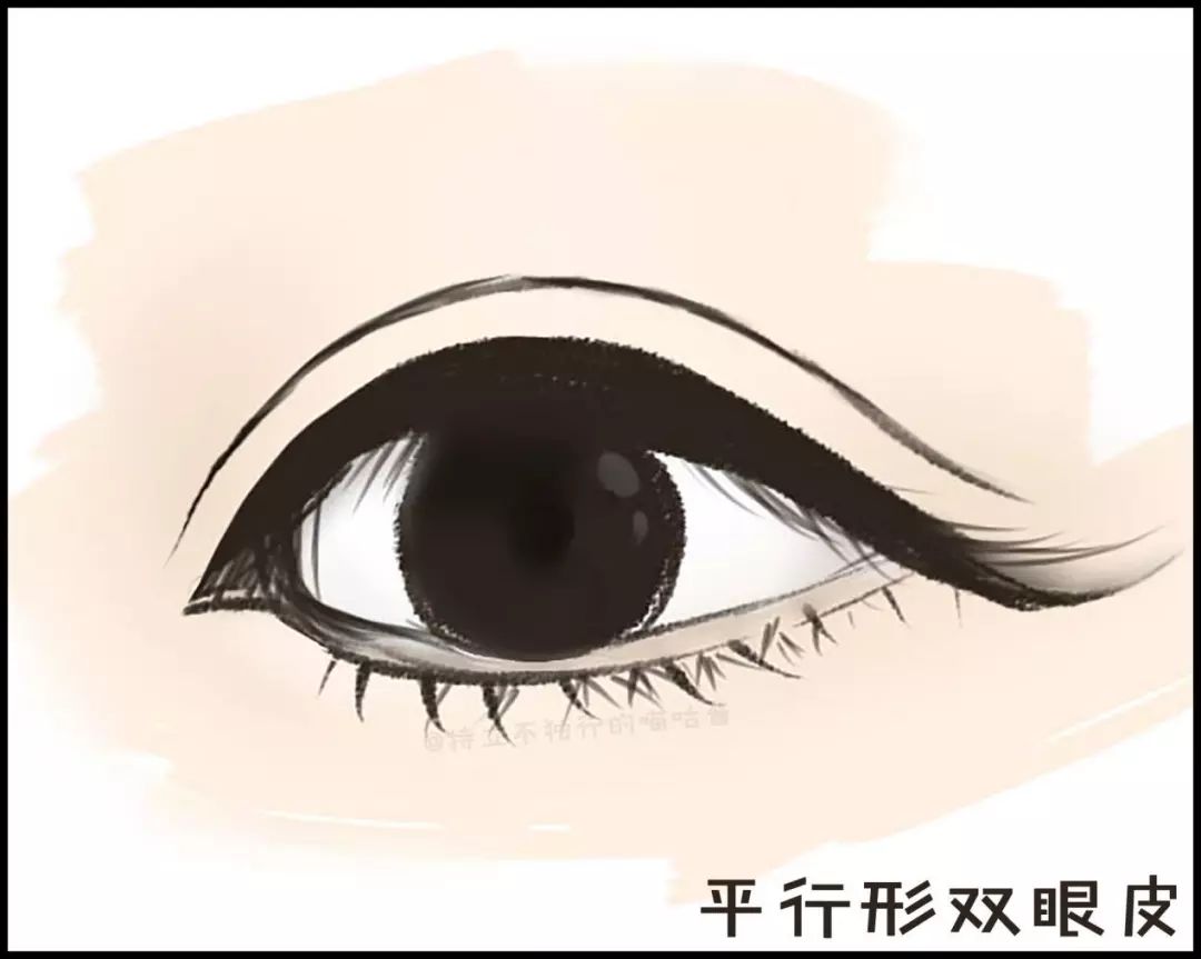 割双眼皮术前术后对比图,割双眼皮术前需要注意事项