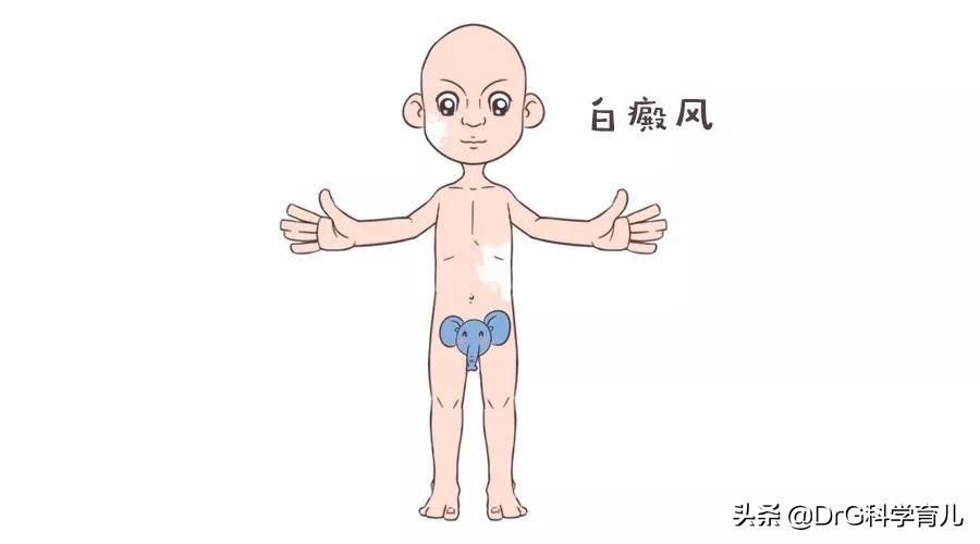天生胎记黑毛痣会癌变会死吗,脖子上有个黑色胎记会癌变吗