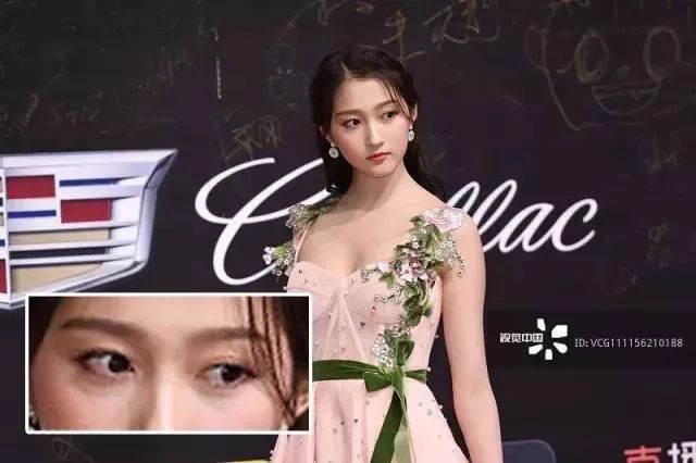 关晓彤有没有黑眼圈,关晓彤黑眼圈困扰