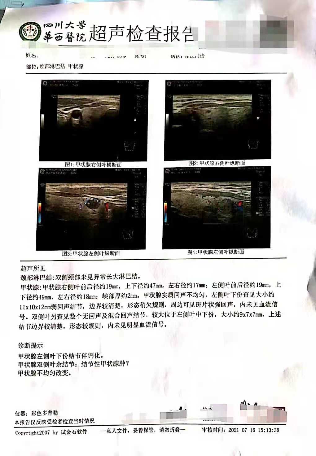 甲状腺超声检查报告点状强回声,甲状腺结节超声报告解读