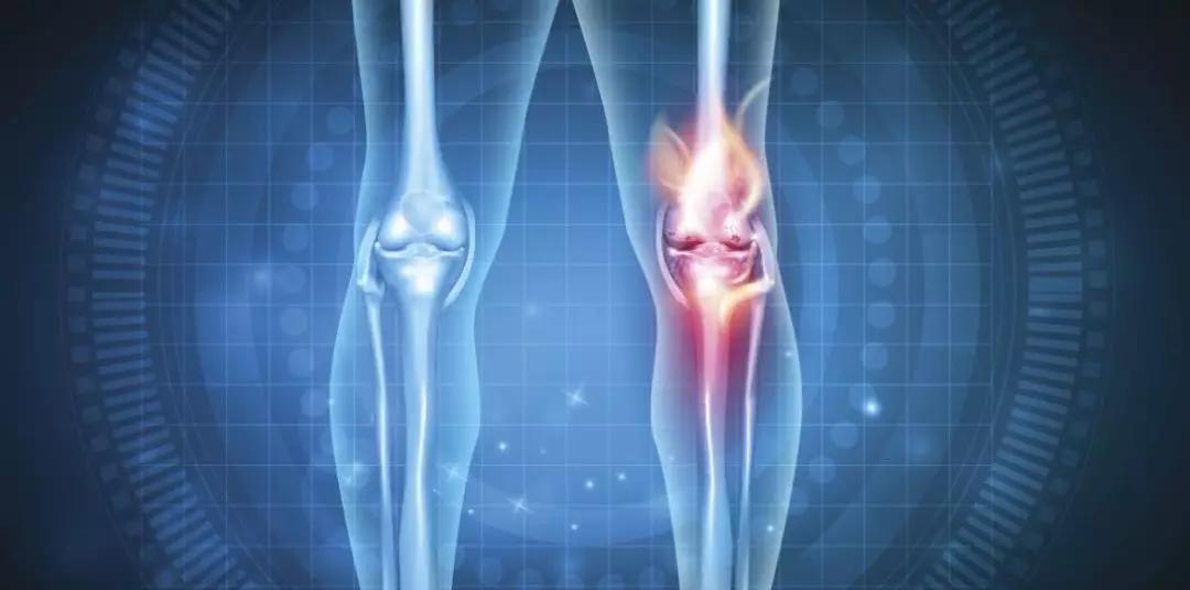 股骨头坏死大腿肌肉萎缩恢复训练,股骨头坏死肌肉萎缩还能恢复吗