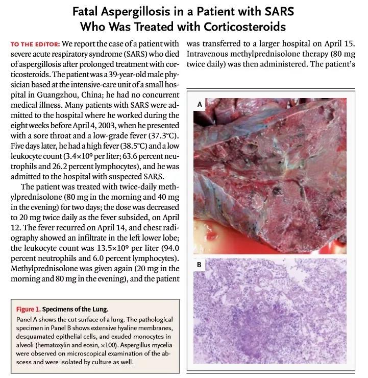 糖皮质激素治疗新冠病毒感染发热,糖皮质激素治疗新冠嗅觉丧失