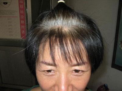 老年人染发是干头发还是湿头发好,老年人总染发有什么危害