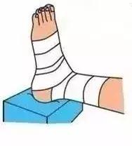 脚踝扭伤韧带损伤怎样康复训练,踝关节扭伤的急救原则