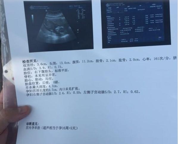 备孕无果要注意什么,备孕苦尽甘来