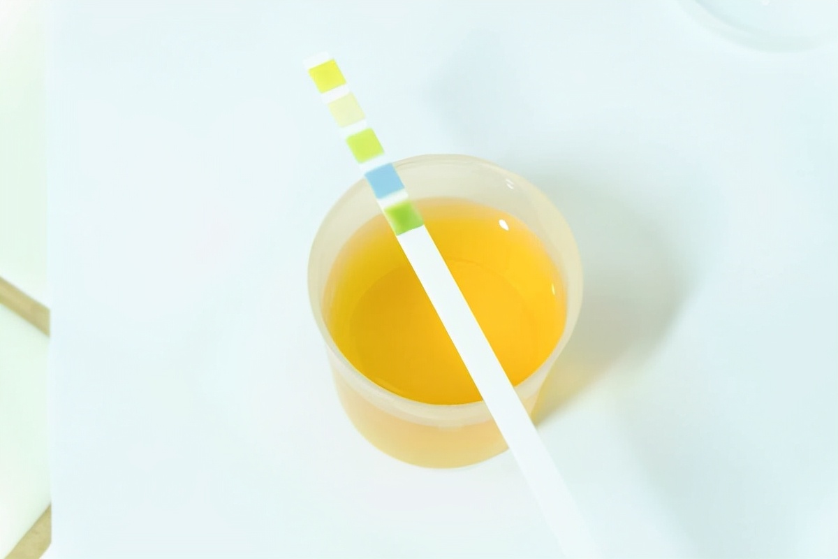 尿意急尿不尽尿多什么情况,尿意急尿不出小腹疼