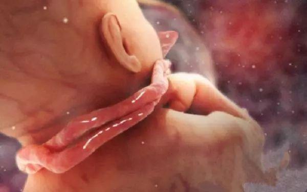 胎儿在几个月容易出现脐带绕颈,胎儿为什么会出现脐带绕颈的情况