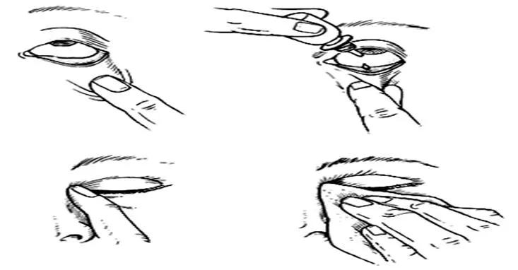 眼用半固体制剂有哪些,眼用制剂的正确使用方法