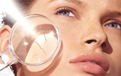 为什么特别容易高原红,高原红的脸如何消除