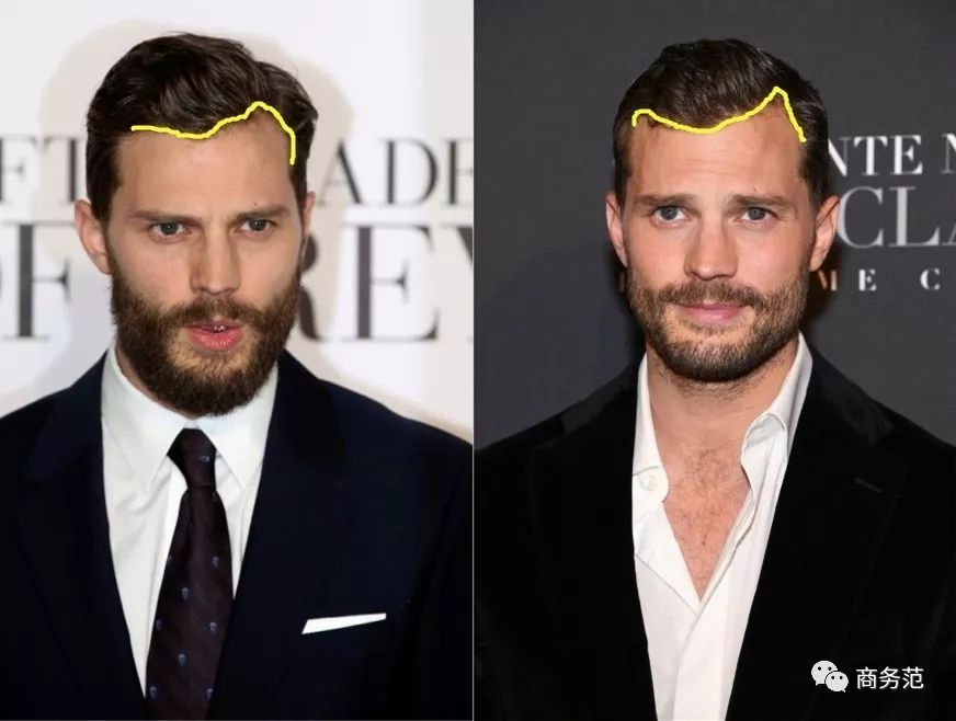 威廉王子秃顶了哈里为啥没秃顶,威廉王子为什么喜欢秃顶