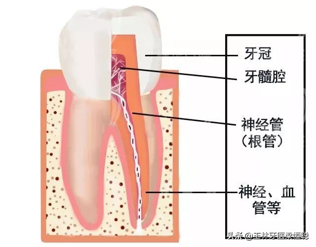 牙齿发炎的原因及解决方法,牙齿发炎特别严重要拔掉