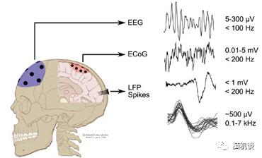 ​《脑机往事（3）—维达尔的秘密》