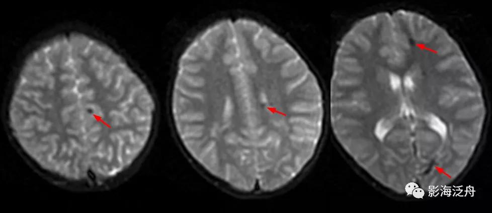 棰呰剳纾佸叡鎸痙wi搴忓垪,棰呰剳dwi搴忓垪鏈鏄庢樉寮傚父