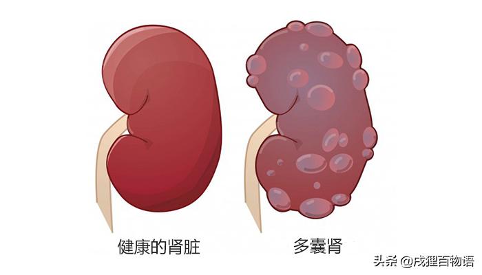 猫咪遗传性肾衰竭会死吗,猫咪肾脏肿大疾病有哪些