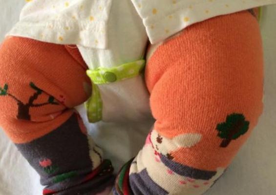 三岁宝宝每天晚上睡前喊屁屁疼,孩子说屁屁疼