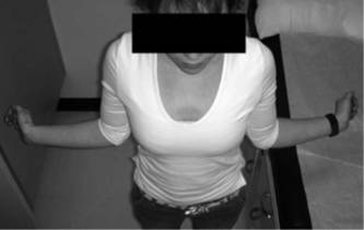 肩关节评定量表cms,肩关节功能评估法cms