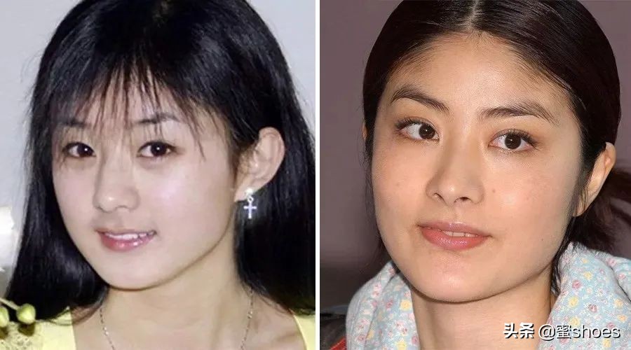 高发际线到底要怎样才能好看,如何弥补发际线太高的缺陷