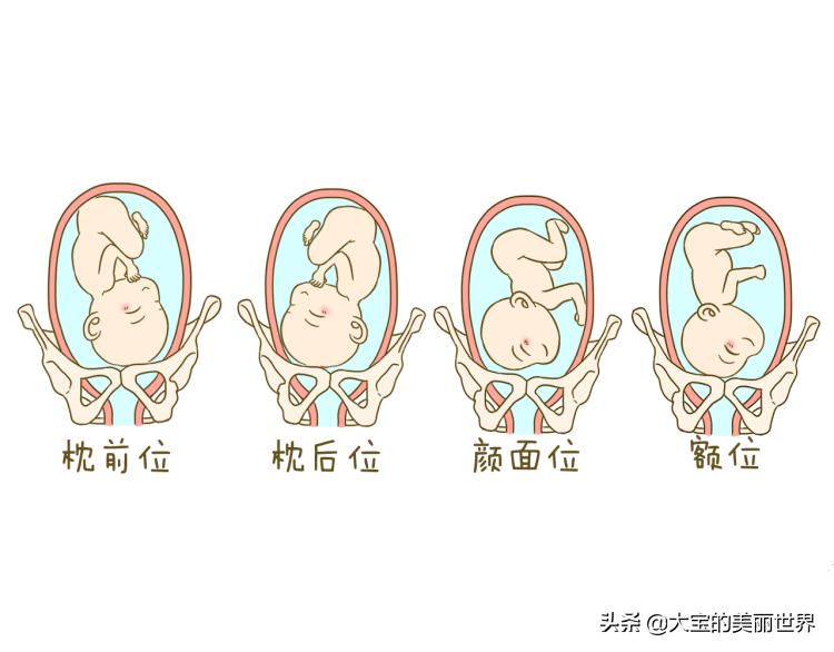 孕期胎位不正准妈妈莫慌张！