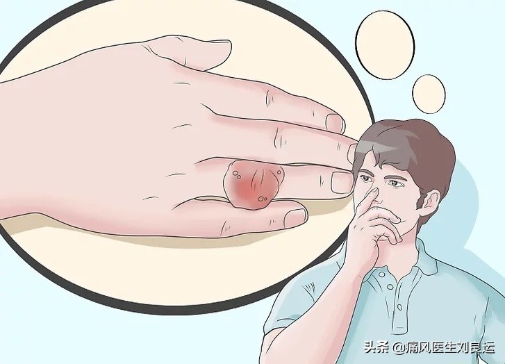 痛风痛起来有多厉害,痛风为什么疼得这么厉害