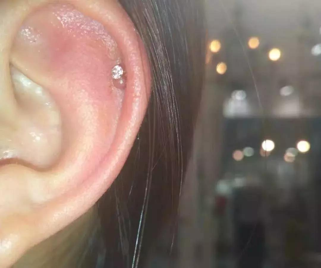 想打耳洞又怕打了不好看,想打耳洞但是怕耳洞长脏东西