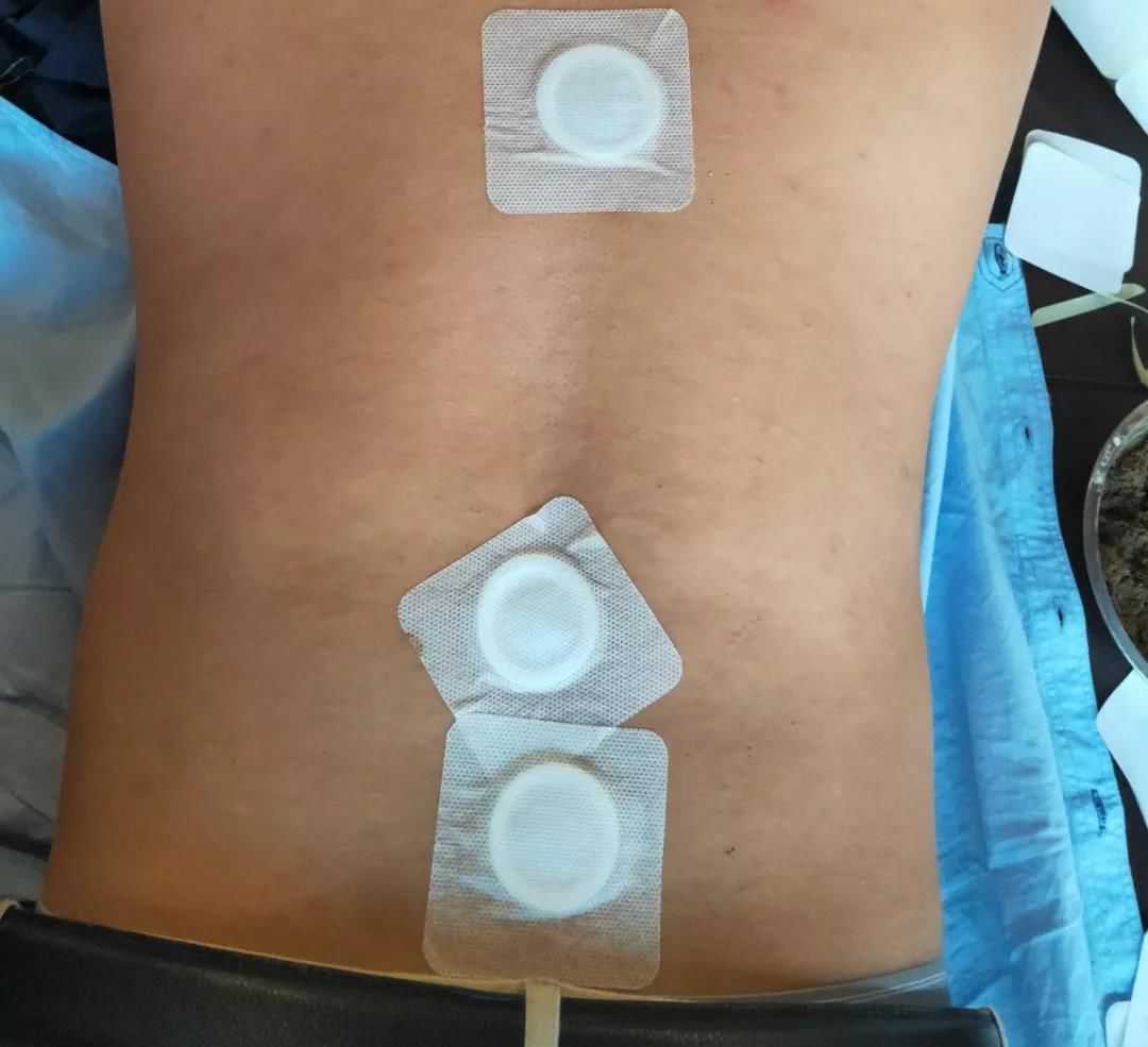 冬天手脚冰凉只需一招,手脚冰凉又怕热是怎么回事