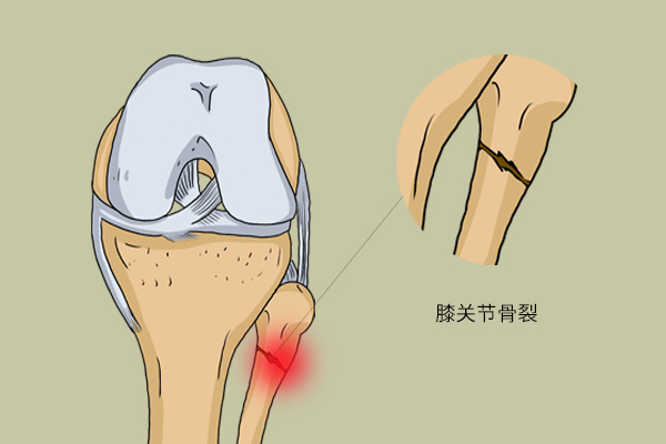 关节损伤的原因及处理方法,关节损伤要多久恢复正常