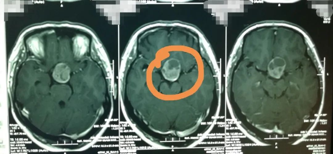 想怀孕二胎怀不上怎么办,想怀孕二胎怀不上应该检查什么