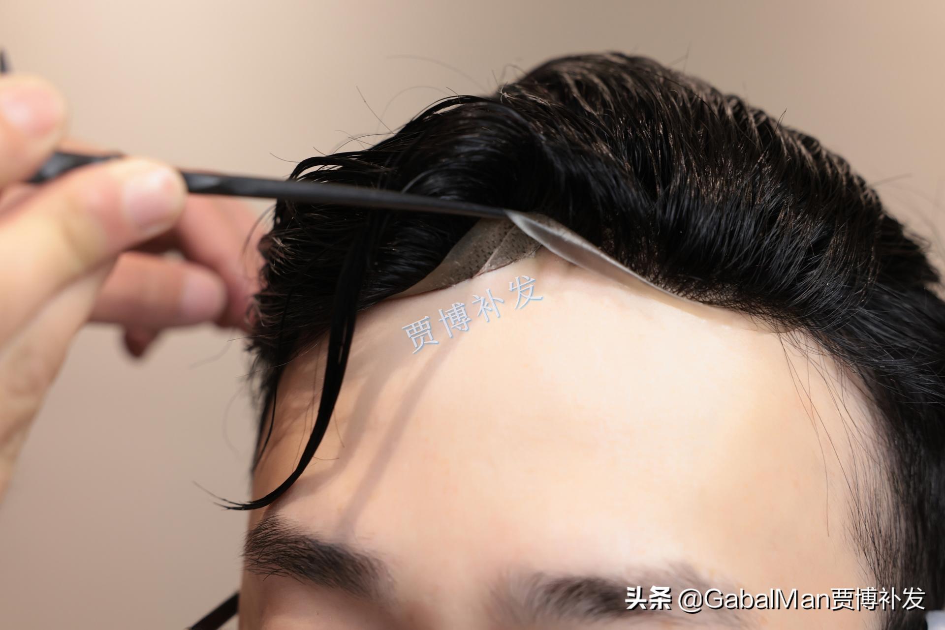 60分钟拯救你的秃头形象,发际线高拯救视频