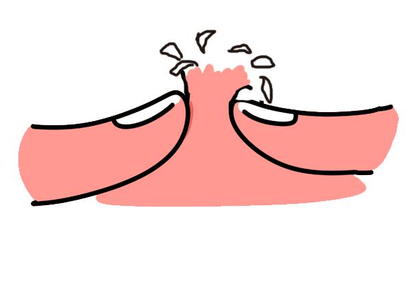 科普微针祛痘,消炎修复和祛痘