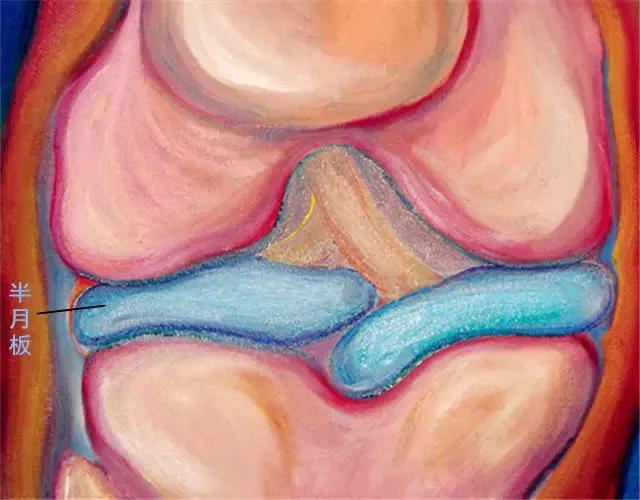 膝关节置管术和膝关节置换修补术,膝关节置换与全膝关节置换的区别