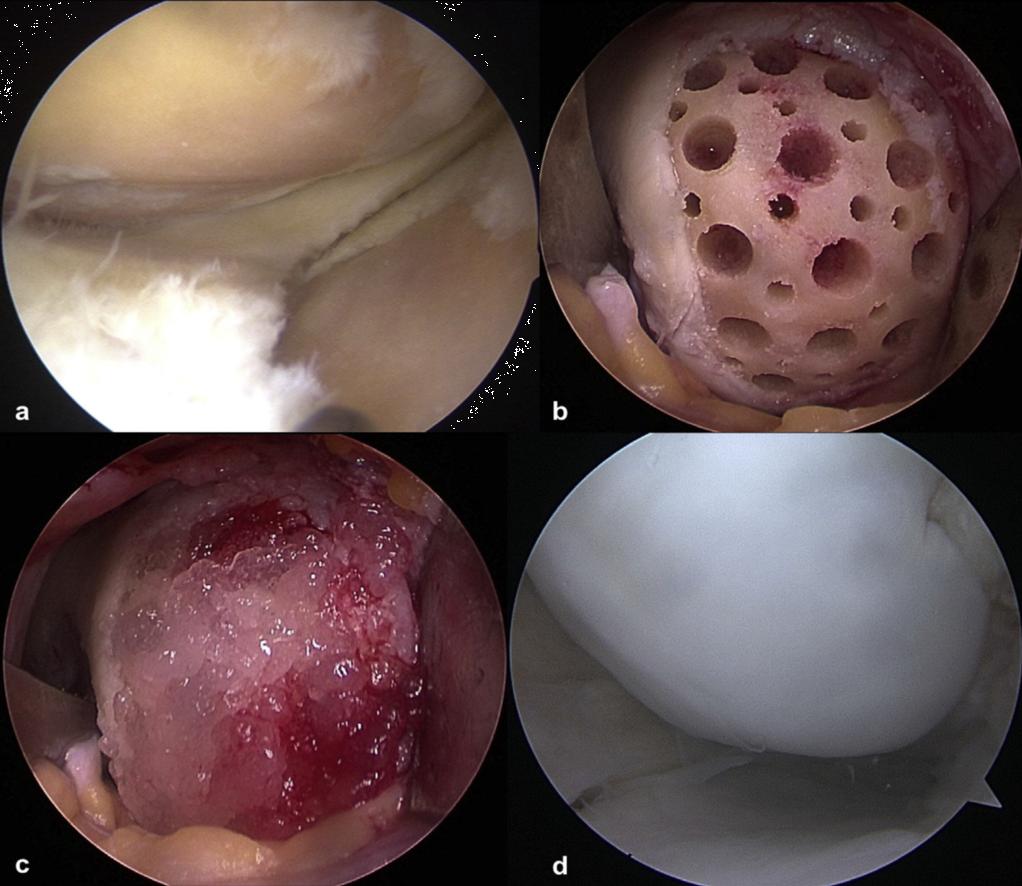 脐血治疗案例,脐带血治疗临床数据