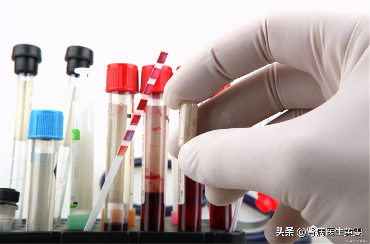 肾病患者血肌酐轻微升高能控制吗,肾病引起肌酐高怎么办如何降