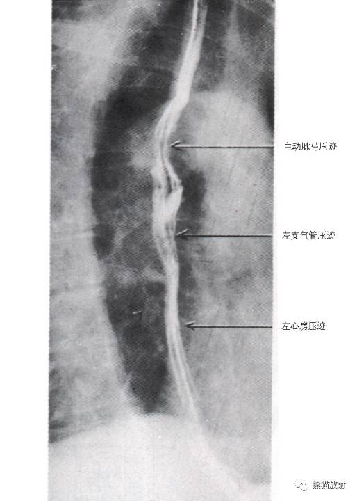 详细的消化道造影+彩色解剖图