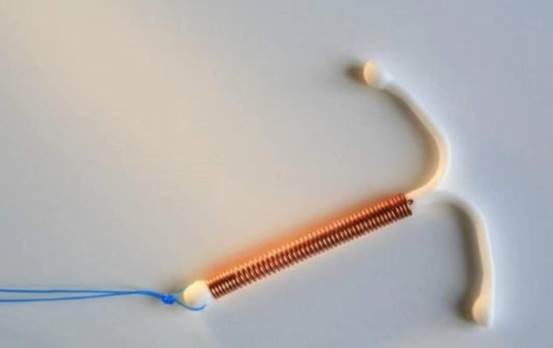 上环30多年，却不知道环有“保质期”，很多上环女性现状让人心疼