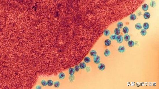 猫也有艾滋，不传人还可能不发病，关于“猫艾滋”你了解多少？