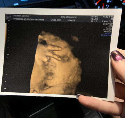 孕妈肚子里孩子反应很大搞笑视频,孕妈产检发现多了个宝宝