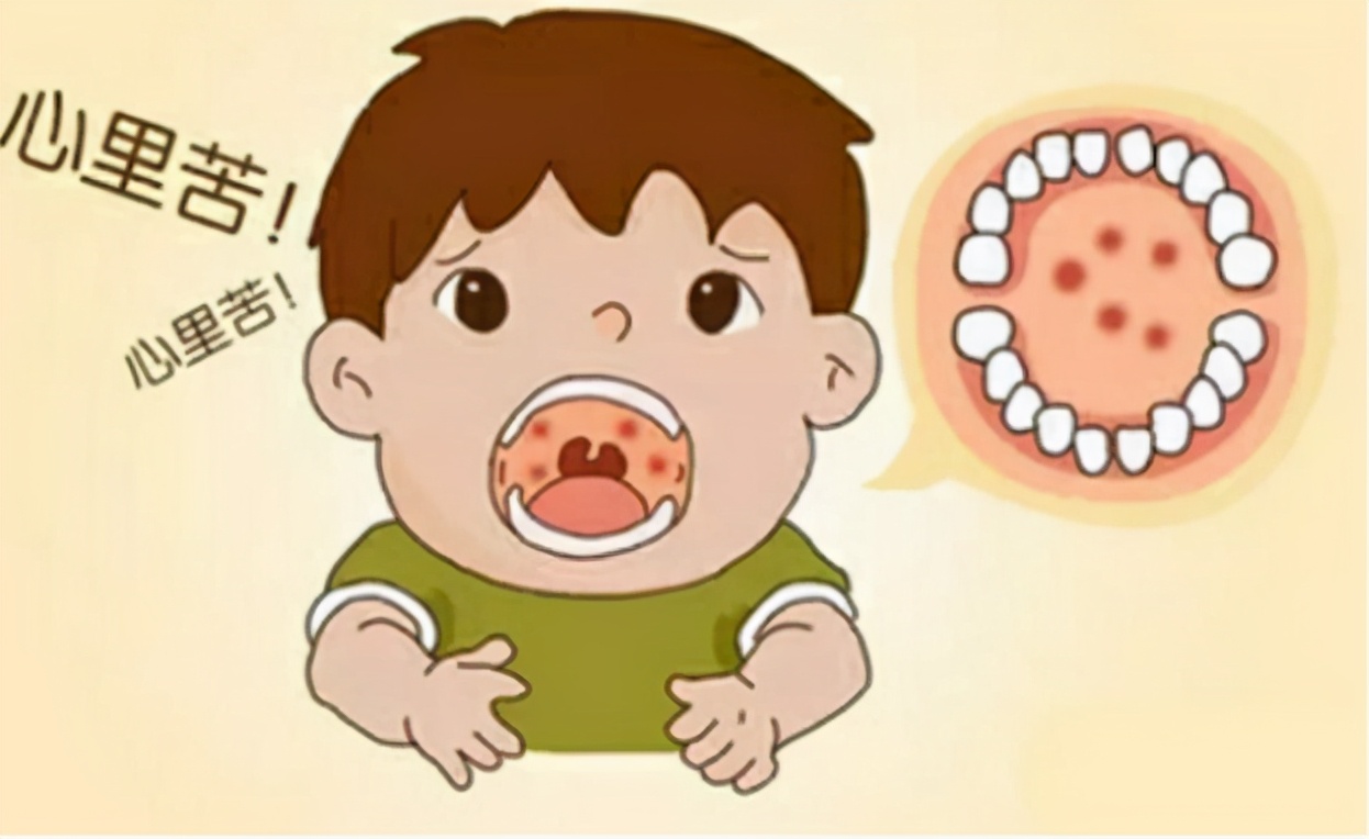 口腔黏膜有白色水肿怎么办？也许你该试试这个……