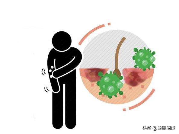 身上突发的肉疙瘩是瘤？会癌变？医生：或与5种疾病有关，需留意