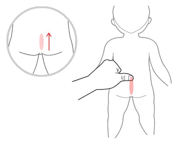 小儿推拿21种手法合集，轻松解决各种常见病