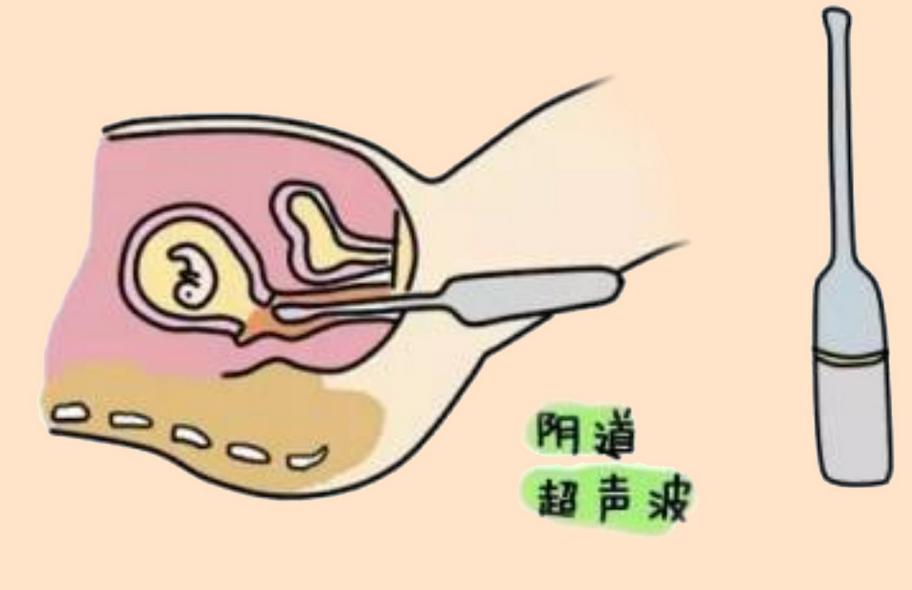 内检遇到男医生很尴尬？别慌，阴超遇到男医生才知道什么是尴尬
