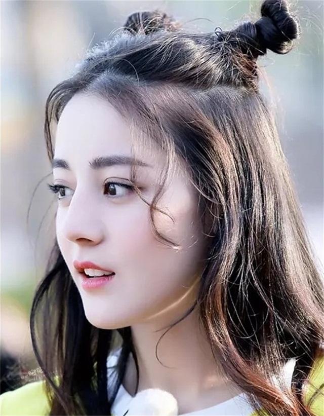 一招教你解决发际线后移,发际线秃了怎么拯救真实案例