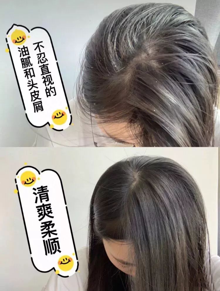 2021年平价去屑洗发水推荐测评,好的洗发水去屑顺滑蓬松控油止痒