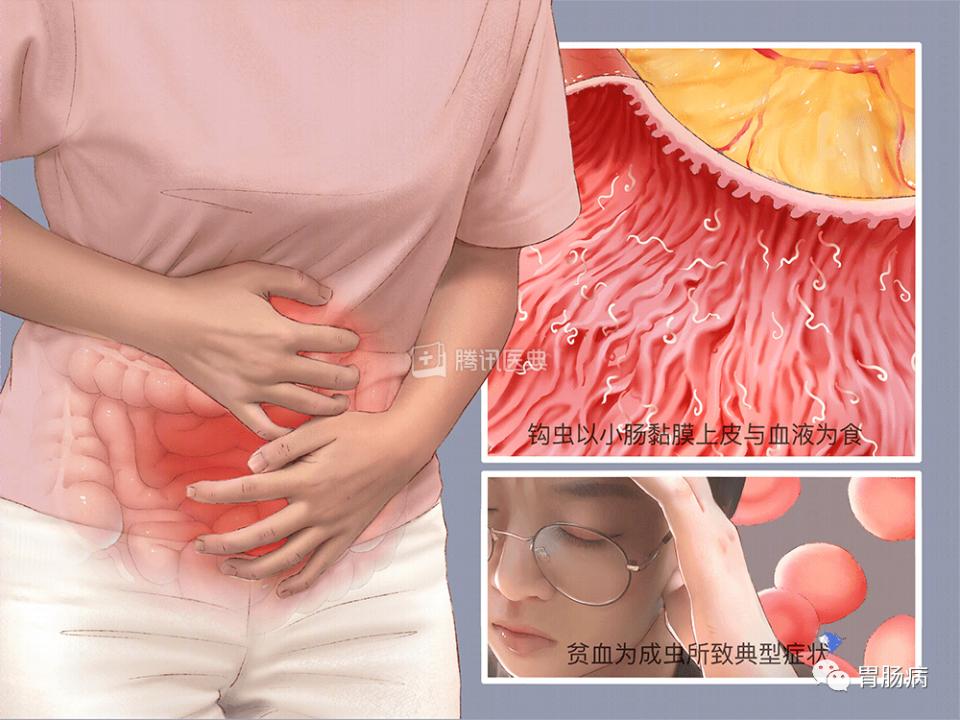 腹痛查不出病因全部检查都做了,腹痛查不出病因视频