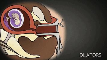 堕胎可怕吗,堕胎到底多可怕