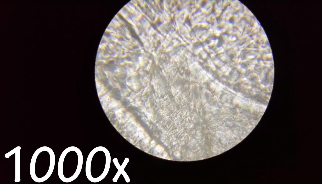 耳屎用显微镜放大是什么样,耳屎在显微镜下是不是活的