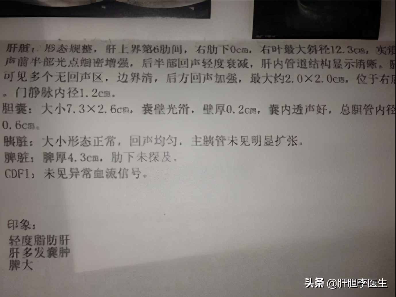 体检有肝囊肿要不要治疗,体检有肝囊肿需怎样解决