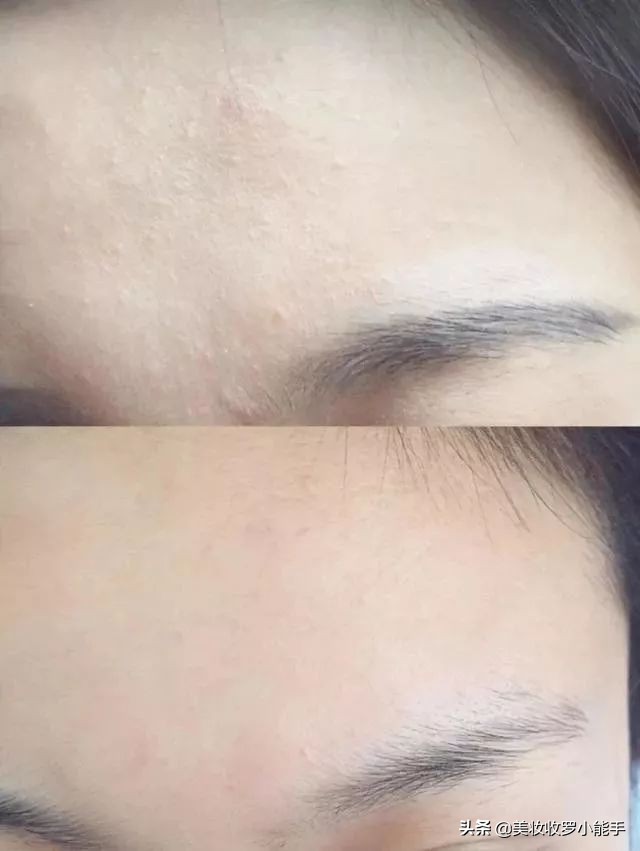 takami闭口精华液,日本takami美容液